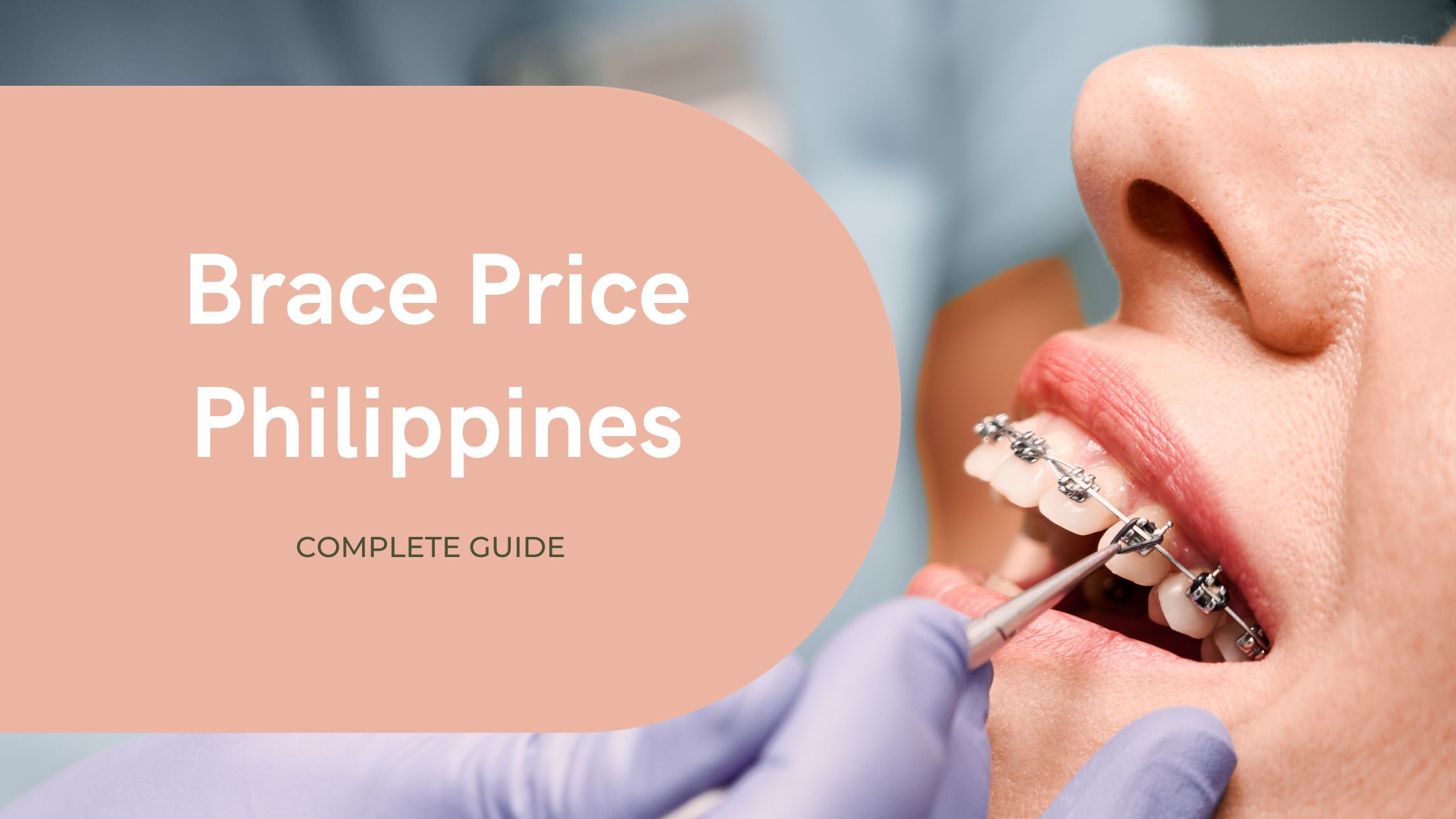 Brace Price Philippines